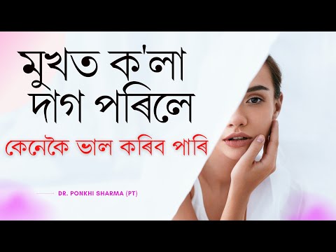মুখত ক'লা দাগ পৰিলে কেনেকৈ ভাল কৰিব পাৰি || Dr. Ponkhi Sharma (PT)