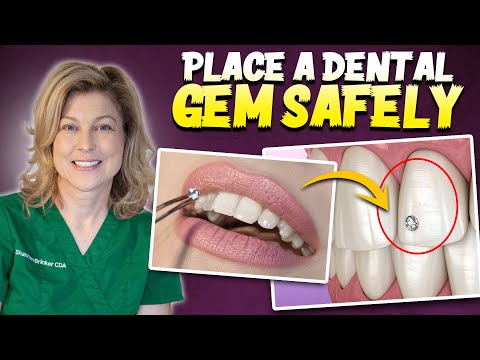 How to place dental gems in the DENTAL OFFICE!!!