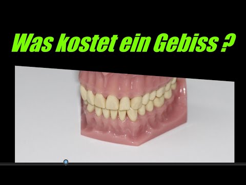 How much does dentures cost in Hungary? How much does a porcelain tooth cost? Firsthand tips!