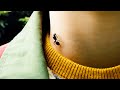 A BOY MOCKED BY EVERYONE Gains SUPERPOWERS After Being Stung By An ANT RECAP