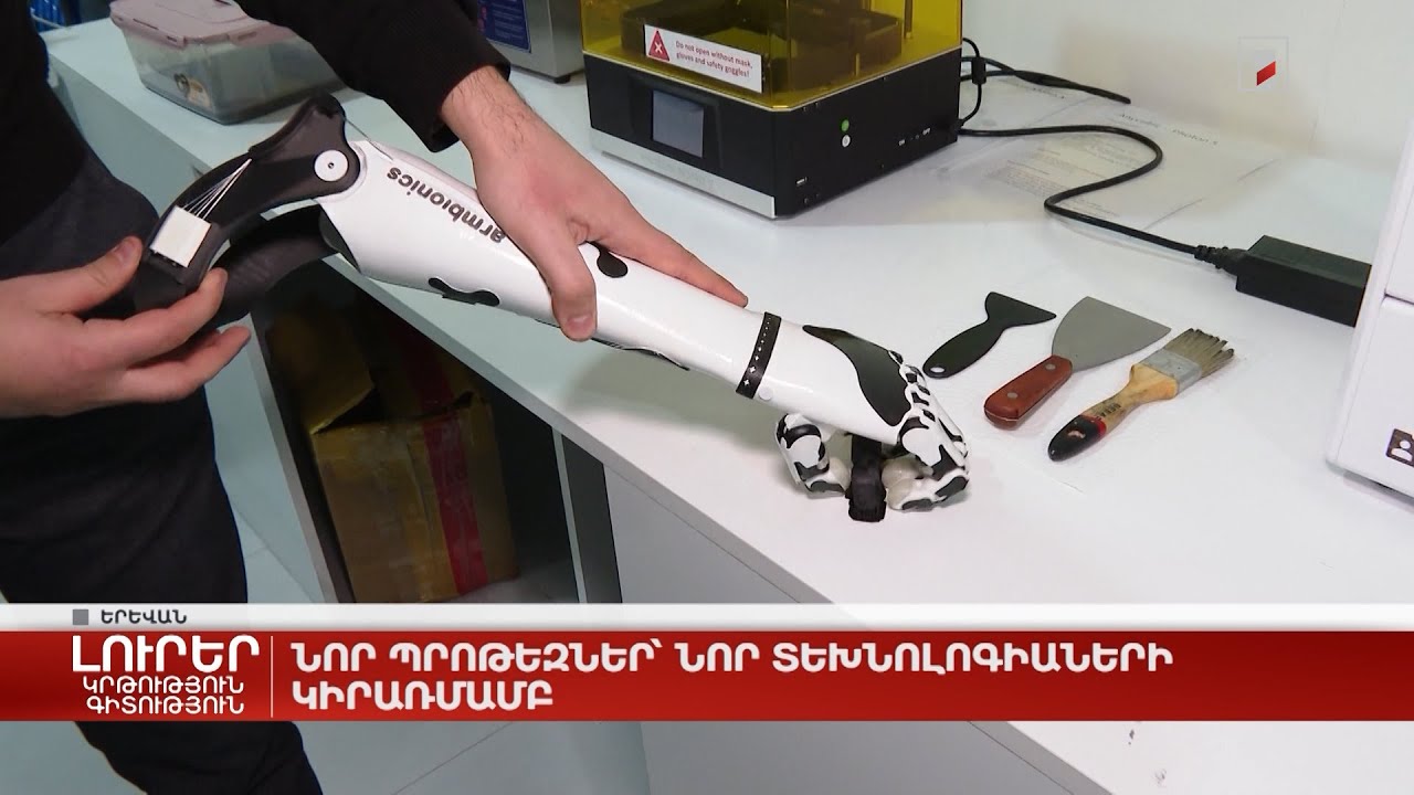Նոր պրոթեզներ՝ նոր տեխնոլոգիաների կիրառմամբ