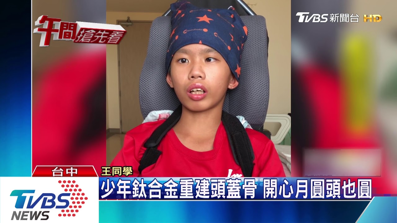 少年鈦合金重建頭蓋骨 開心月圓頭也圓