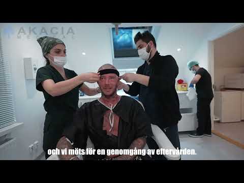 Så här går en hårtransplantation till på Akacia Medical