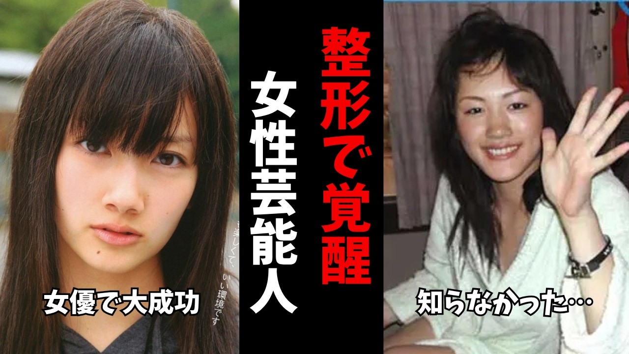 【ガルちゃん芸能】最強になっている...整形で覚醒した女性芸能人【有益2ch】