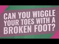 Can You Wiggle Your Toes With A Broken Foot