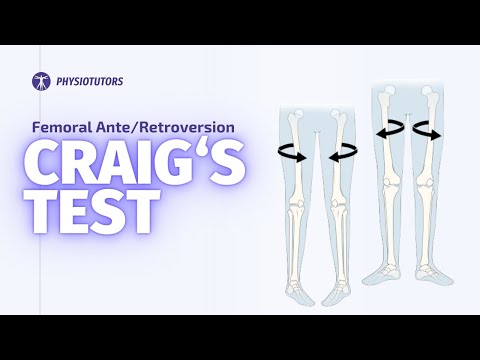 Craig's Test | Femoral Anteversion
