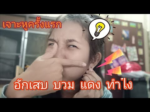 โรคสะเก็ดเงินหยุดซื้อ Neurodermatitis และ Nuga ที่ดีที่สุด
