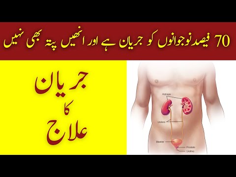 Jaryan Kia Hai? Alamaat Aur Ilaaj | Gonorrhoea | Gleet | URDU/HINDI | Hakeem Malik Ahmad Farooq