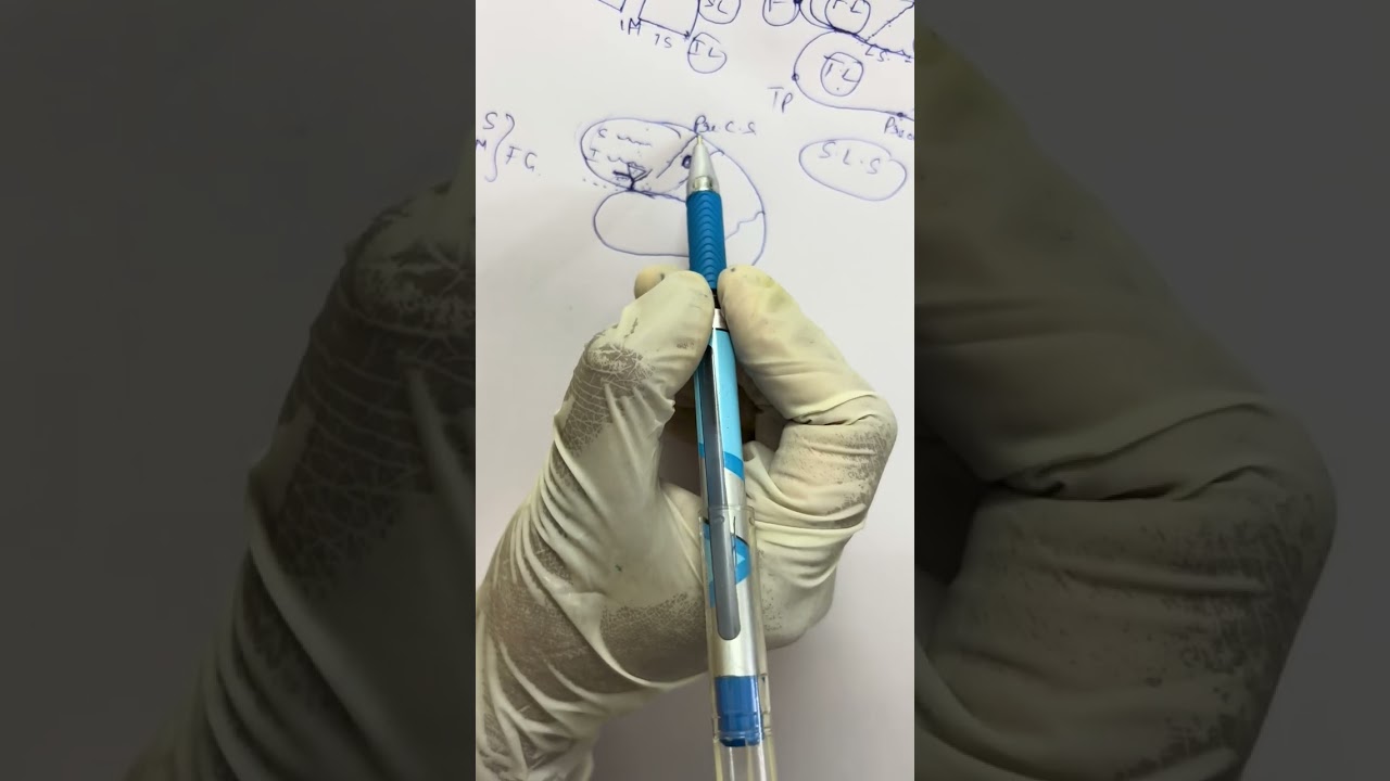 Sulci and gyri of brain 