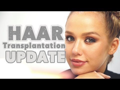 Gloss haartransplantation kim Rocco Stark