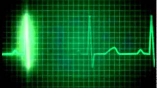 Download lagu Heart Rate Monitor.mov mp3 Download lagu Heart Rate Monitor.mov mp3