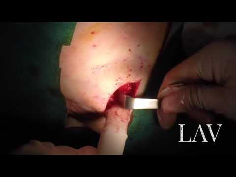 Dolori di stomaco sconvolto alle articolazioni In cui parte di un mal di testa con osteocondrosi cervicale