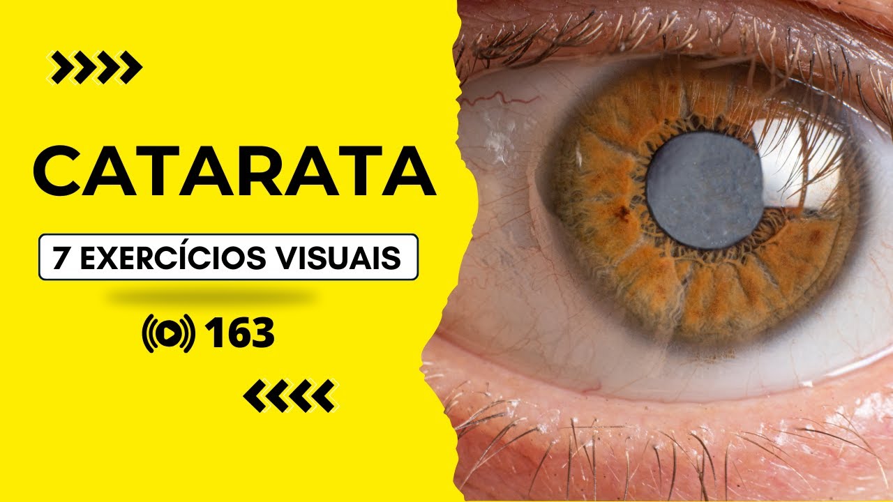 #163 Catarata -  7 Exercícios Visuais.