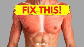 How to Fix Chest Muscle Tightness in 30 SECONDS