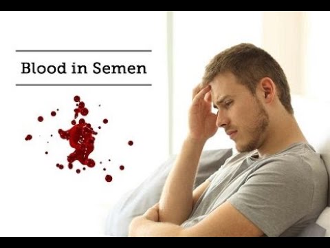 BLOOD IN SEMEN