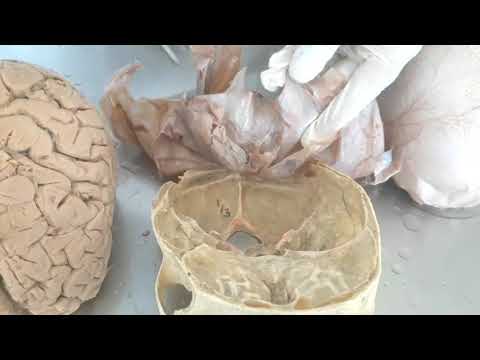 Meninges of the Brain