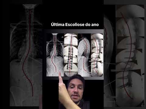 Diego Ramos-9
