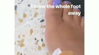 🙏 🙏 4 JANIA FOOT 2 SPEEDY RECOVERY 🙏 🙏