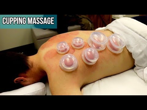 Pro Cupping Massage Techniques