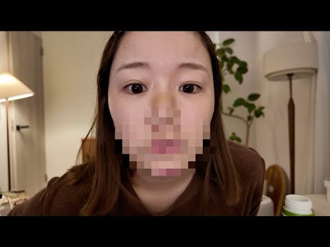 【ガチ】ついにきりまる整形をしました