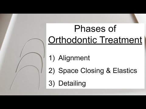 Phases of Tx & Wire Sequence