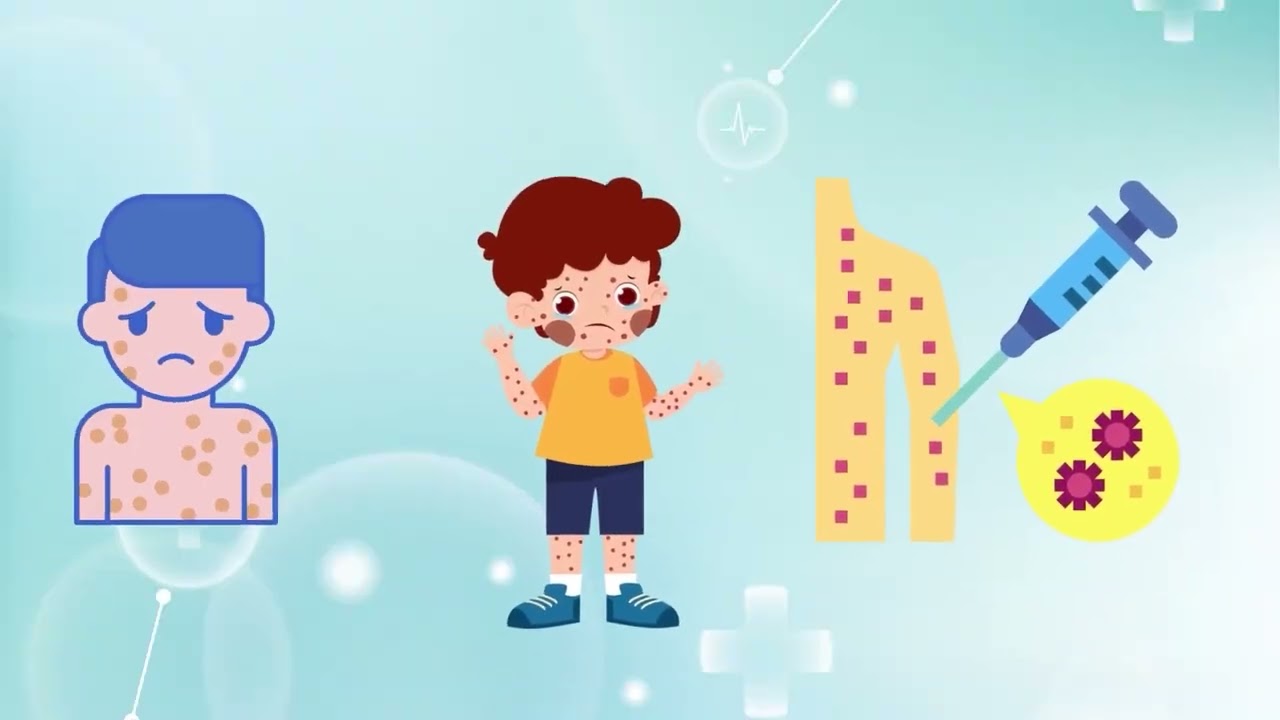 Mpox Alert, Awareness, Educational and Outreach Program Project Progress Showcasing Documentary