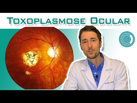 Ocular toxoplasmosis - treatment