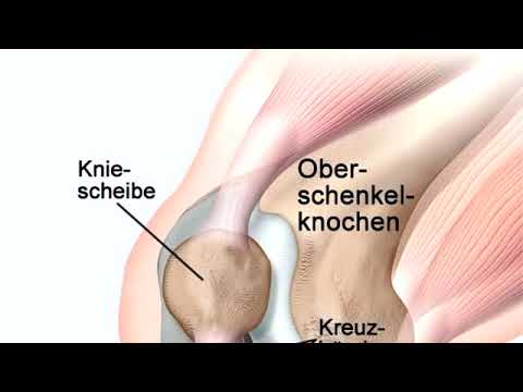 Backen Schmerzen im unteren Rücken Hüfte behandelte Gelatine