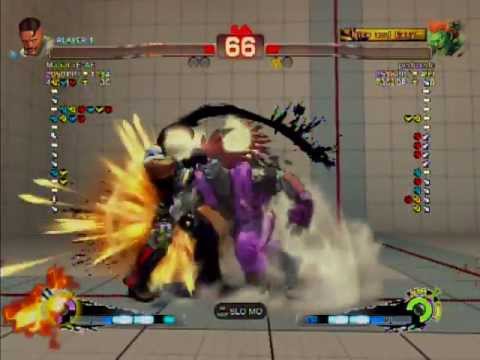 PedroE_BR [Blanka] vs MaSaCrE-AE [Dudley]