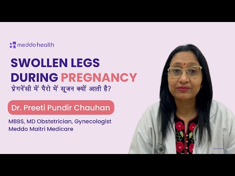Swollen Legs During Pregnancy 