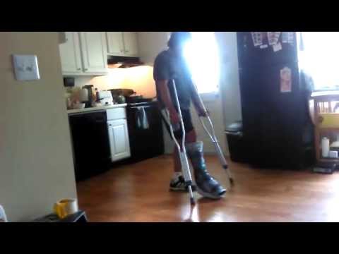 Achilles Tendon Re-rupture non-op Week 4 PWB - 25% VACOcast VacoPed