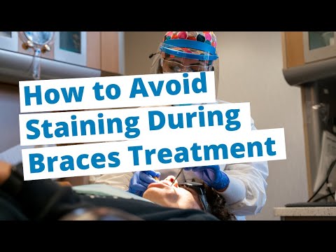 1st YouTube video about are braces stains permanent