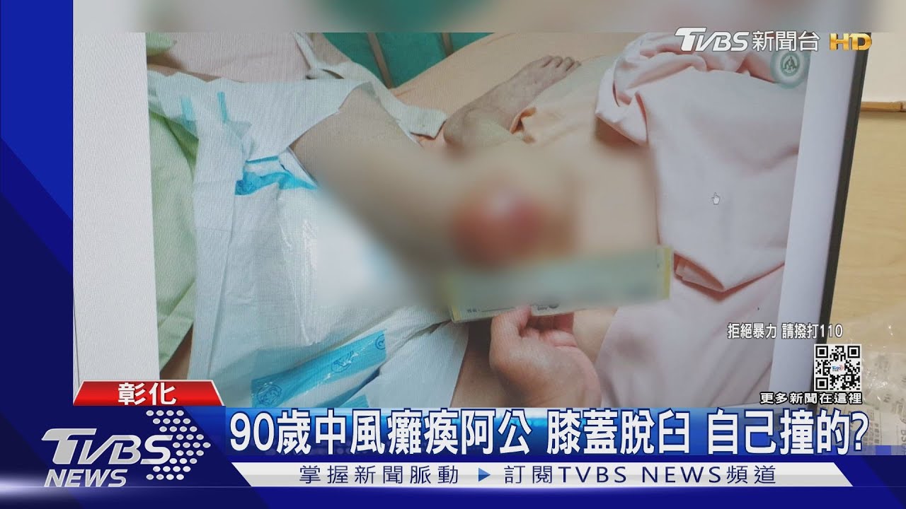 90歲中風癱瘓阿公膝蓋脫臼 自己撞的?