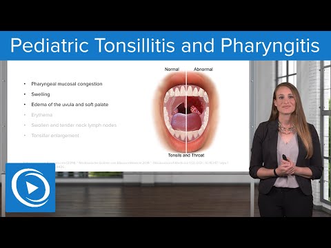 Pediatric Tonsillitis and Pharyngitis – Pediatric Nursing | Lecturio