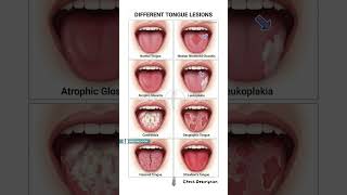 These Tongue Signs Should NEVER Be Ignored ⚠️