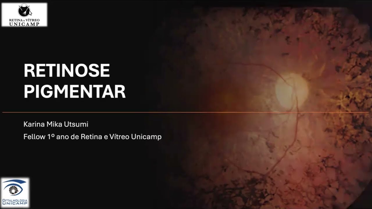 Retina e Vítreo (15/08/2024) - Retinose Pigmentar
