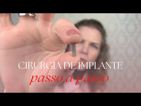 CIRURGIA DE IMPLANTE DENTÁRIO: passo a passo.