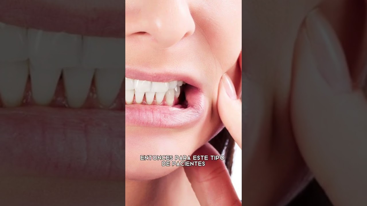 Carime Yule Wagner-19