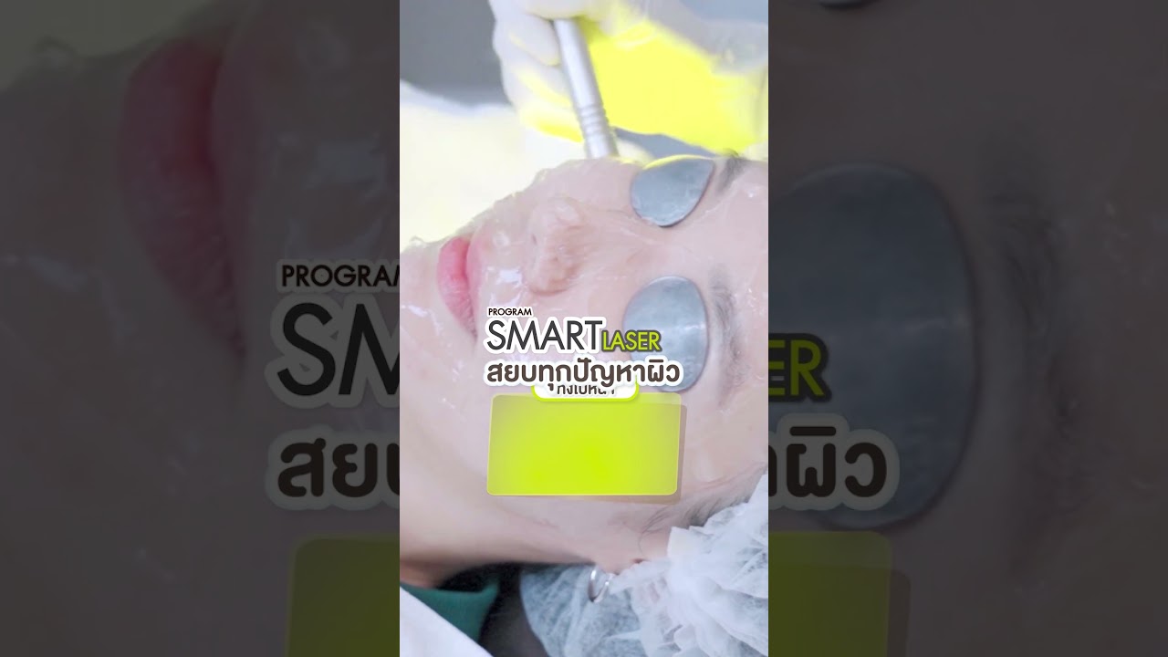 รีวิว Smart Laser และ Color Ice หน้าใส ลดรอยสิว รอยดำรอยแดง