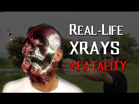 Real Life Mortal Kombat Xrays and Fatality!