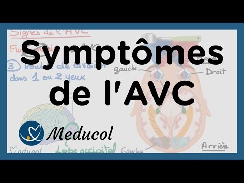 Quels sont les signes d'un AVC : AVC symptômes et AVC séquelles