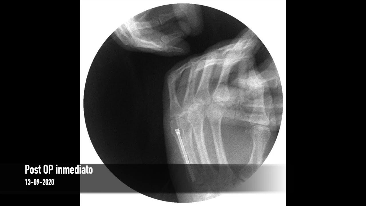 Luis Iram Lozano Parra-16