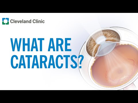 What Are Cataracts? | A Common Cause of Vision Impairment
