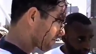 White Man Attacked by Illegal Immigrant/Racist Reporter