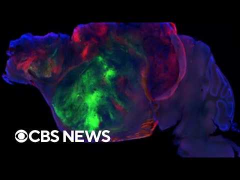 Neuroscientists grew human brain tissue in mice. This is what they discovered.