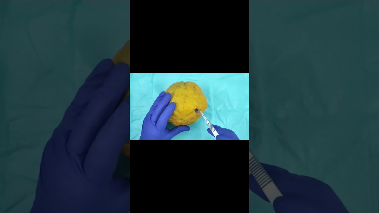 Emergency Fruit Surgery Of  The Old Orange! #doodle #fruitsurgery #funny