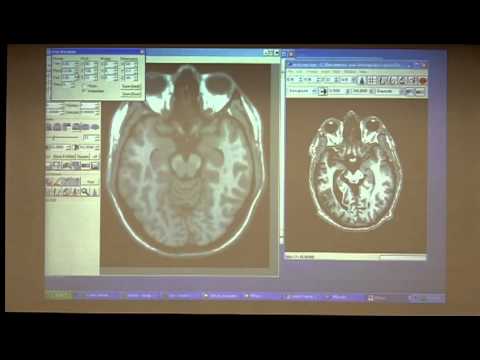 VLSM Mini course (Session 2) 7 of 7