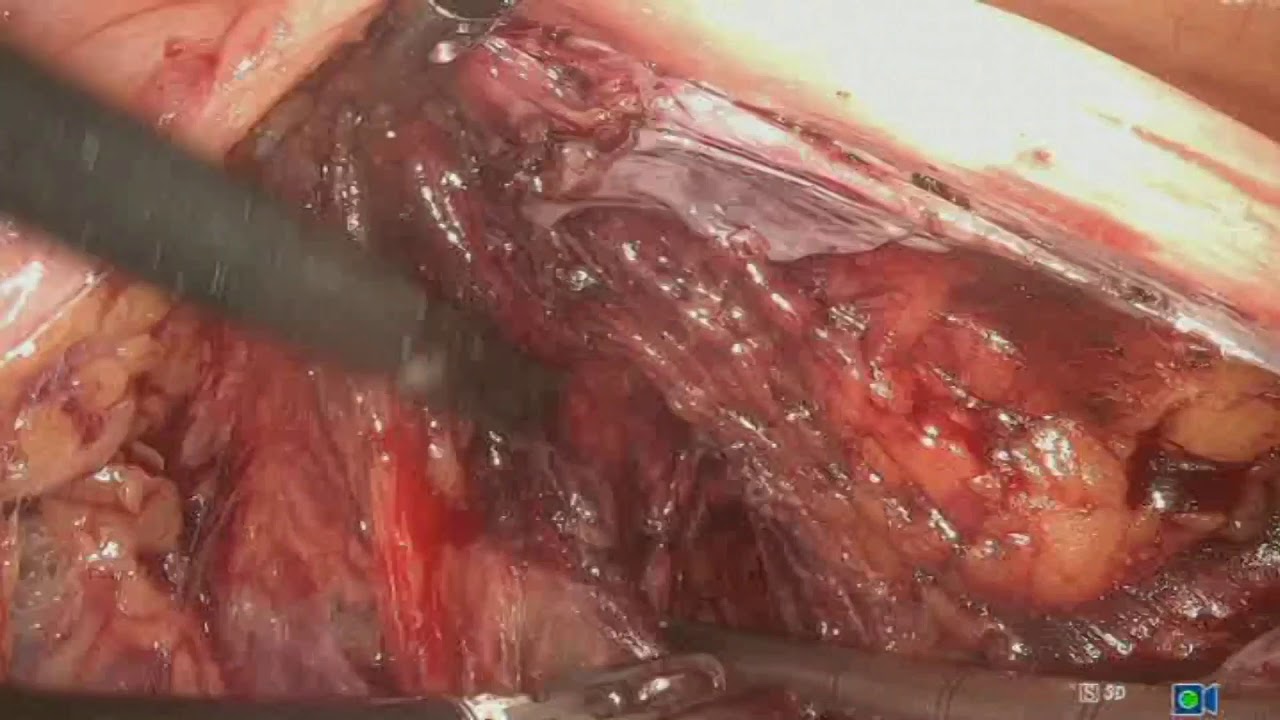 Francesco Chiaradia-5