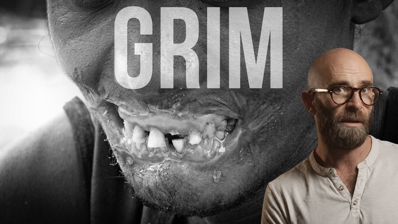Noma: The Disease That Eats Your Face