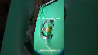 No rubber dam no root canal! #dentists #apexdental #rootcanaltherapy #dentalcare #rootcanal